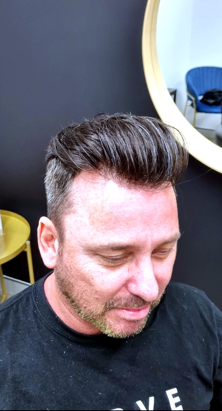 The same client after their Tuffs hair system